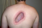 19-radiation-treatments 952028670 o
